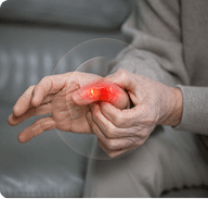 Arthritis