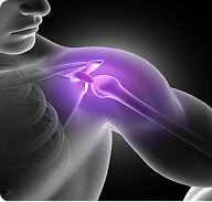 Shoulder Pain