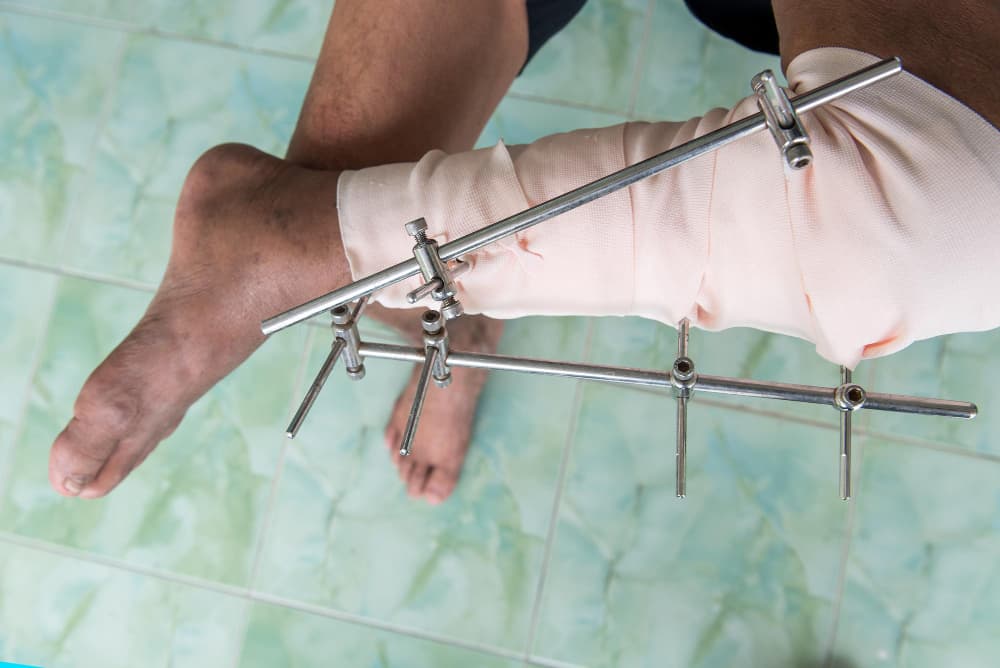 Recovery and follow-up